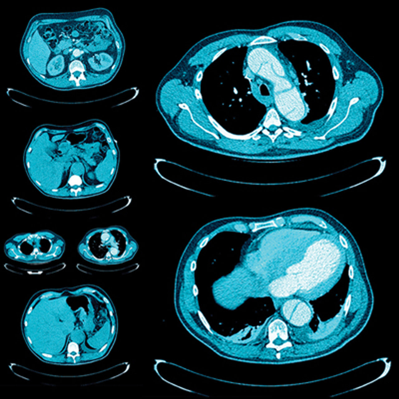 Oakstone UCSF Abdominal & Thoracic Imaging 2025
