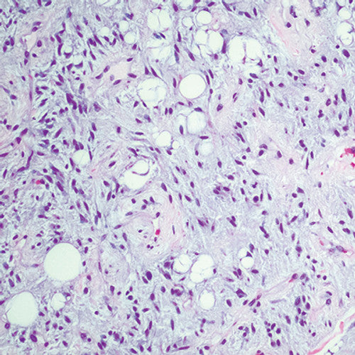 Oakstone Cleveland Clinic Comprehensive and Immersive Soft Tissue Pathology 2025