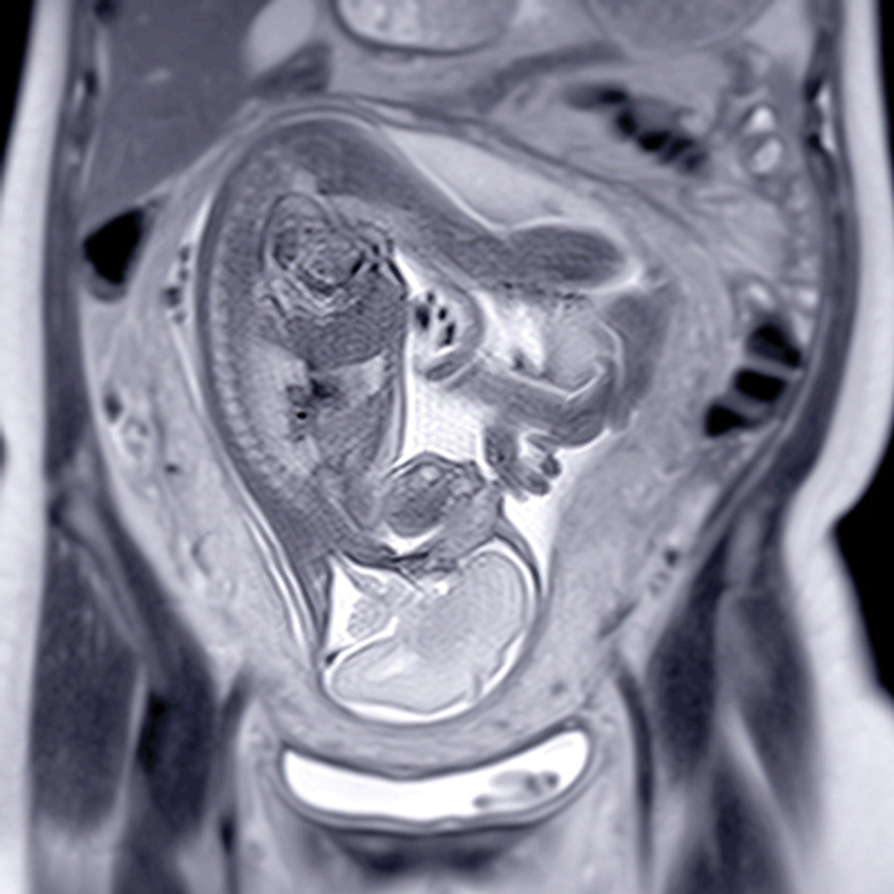 Oakstone UCSF ObGyn Women’s Imaging 2025